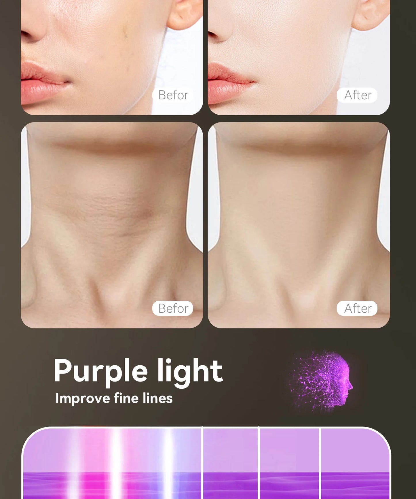 Neck and Chest - Halo White