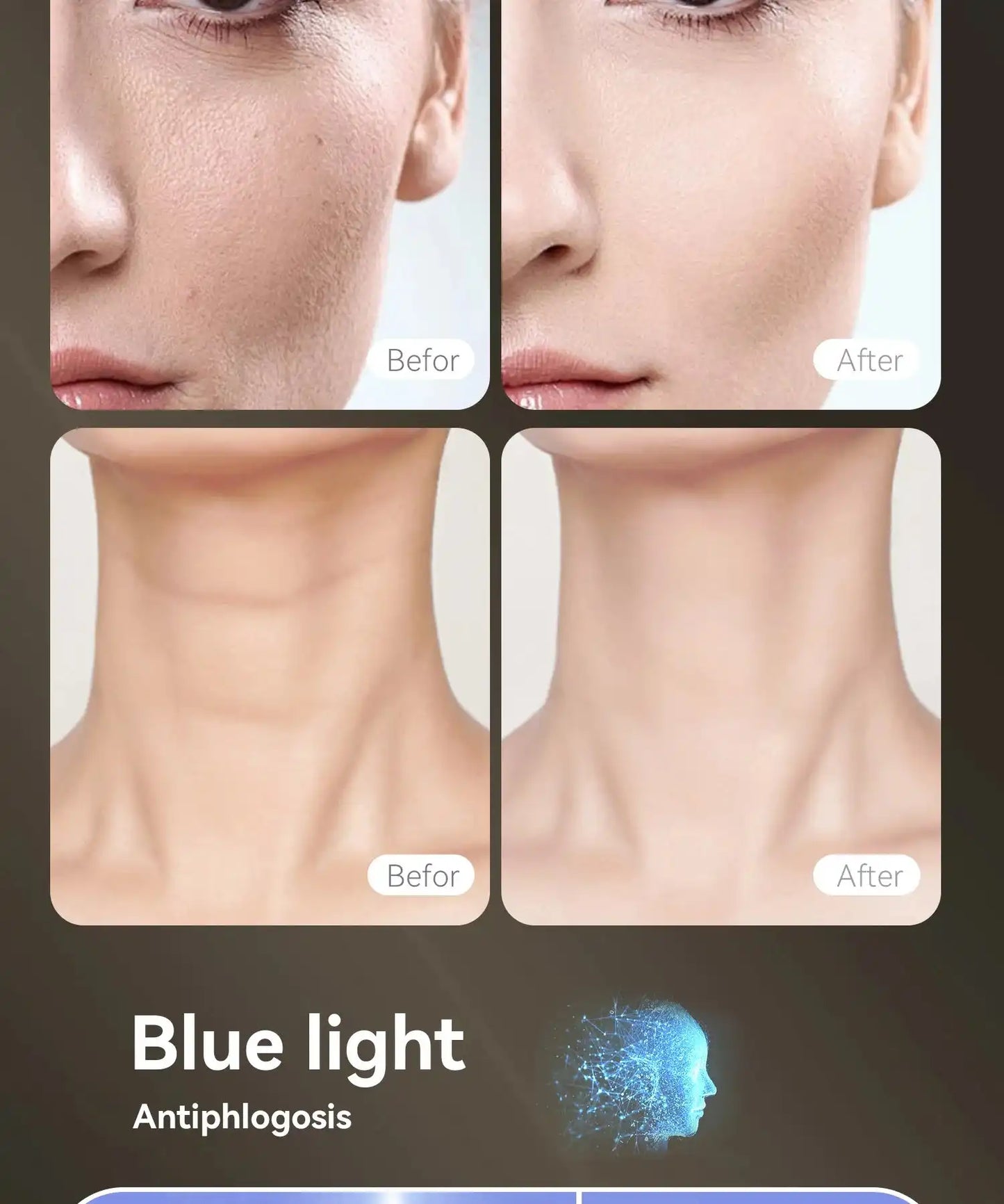 Face Mask Only - Halo White shows before and after results on face and neck, highlighting smoother skin and reduced blemishes with blue light therapy.