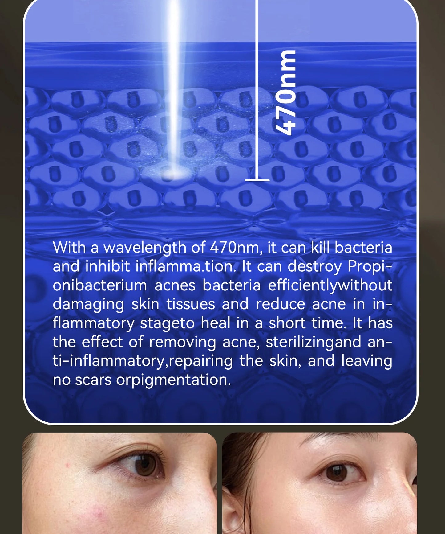 AuraGlow RX Redlight Therapy Face, Neck & Chest Mask