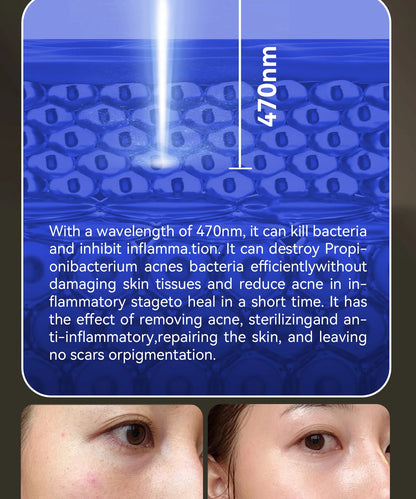 AuraGlow RX Redlight Therapy Face, Neck & Chest Mask